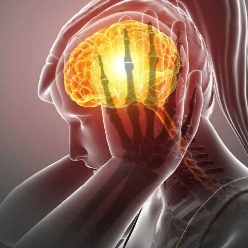 Chronic-migraine-640-x-853-px