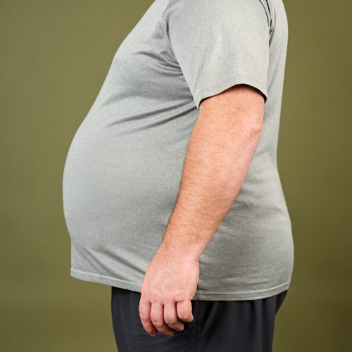 Obesity